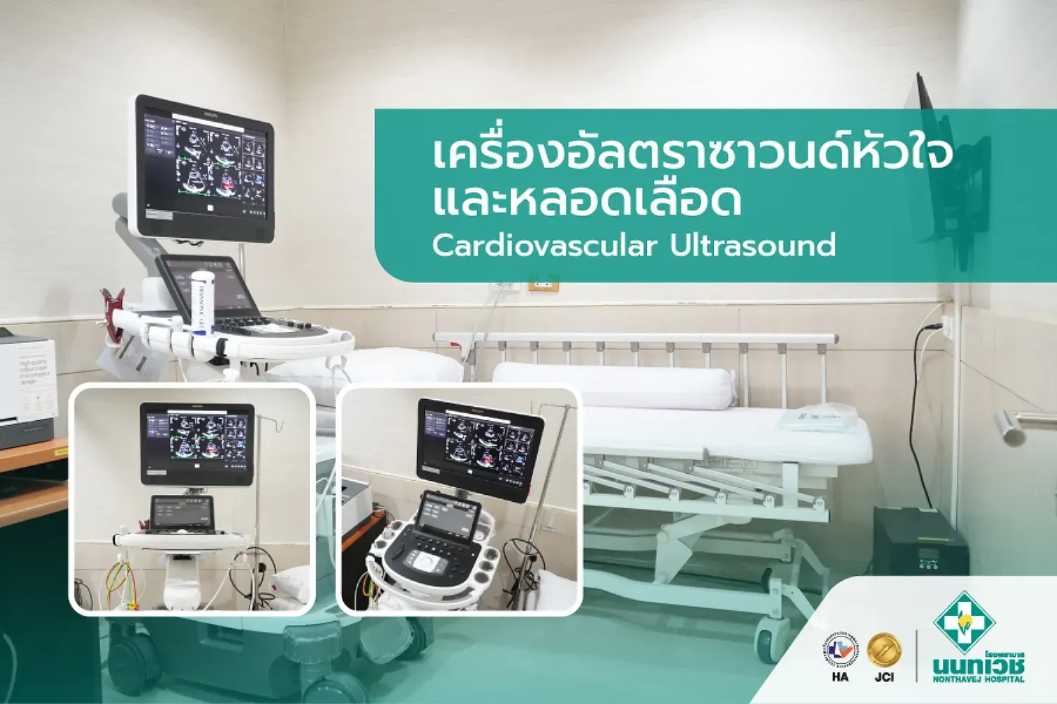 เครื่องอัลตราซาวนด์หัวใจ (Cardiovascular Ultrasound)