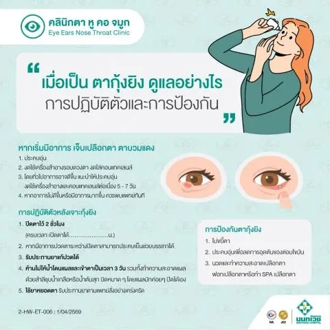 โรคตากุ้งยิง