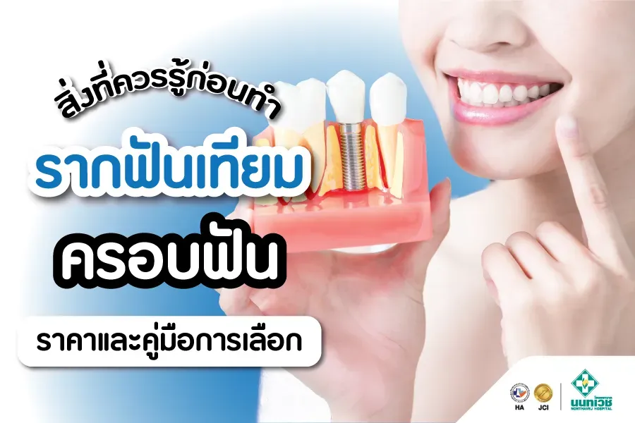 รากฟันเทียม ครอบฟัน คู่มือการเลือกและค่าใช้จ่ายที่คุณต้องรู้