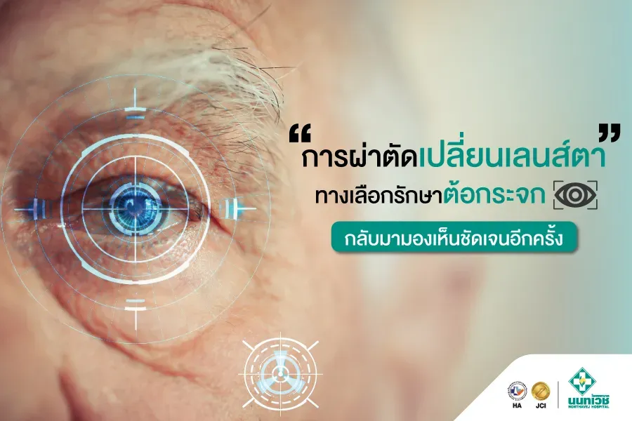 การผ่าตัดเปลี่ยนเลนส์ตา: วิธีแก้ปัญหาสายตาอย่างมีประสิทธิภาพ