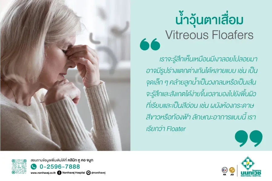 น้ำวุ้นตาเสื่อม Vitreous Floafers