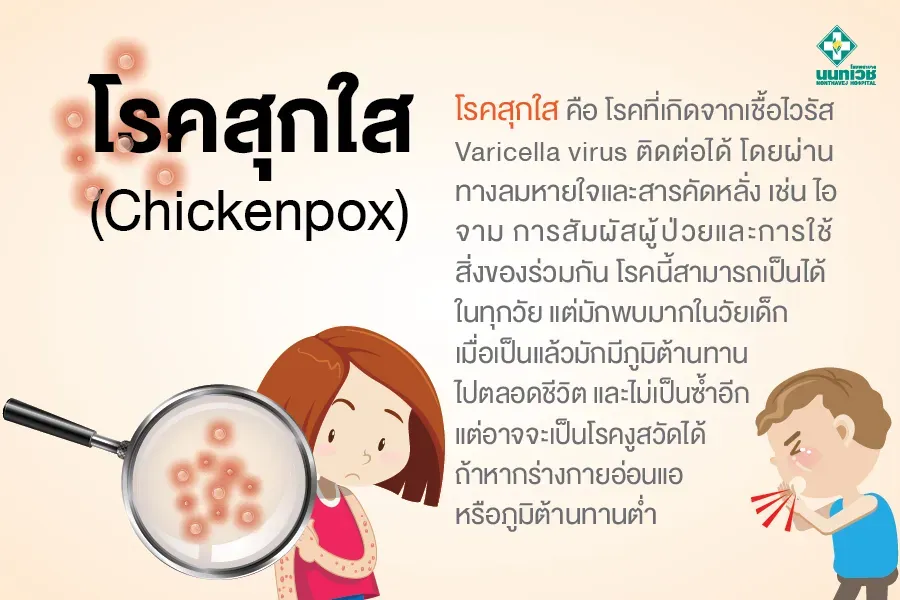 โรคสุกใส