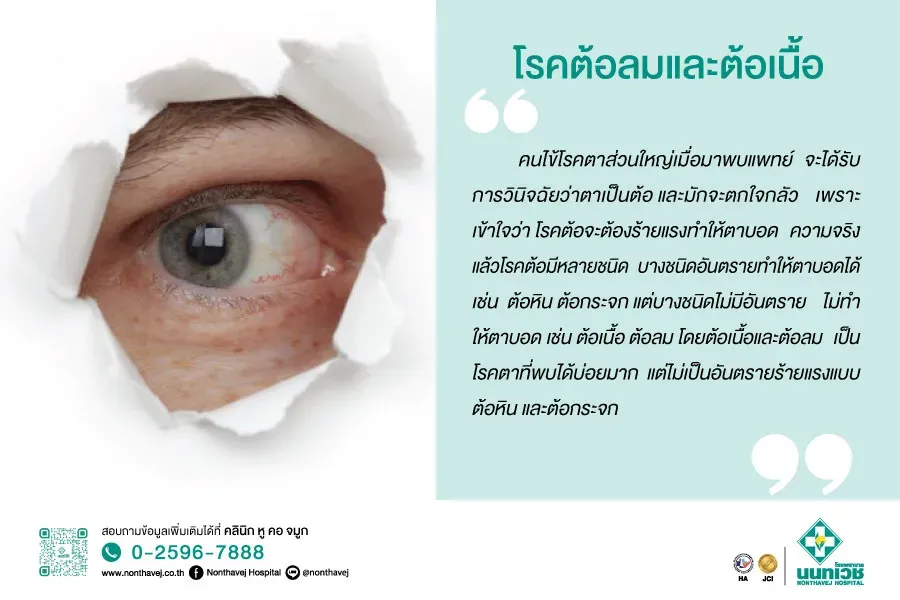 โรคต้อลมและต้อเนื้อ