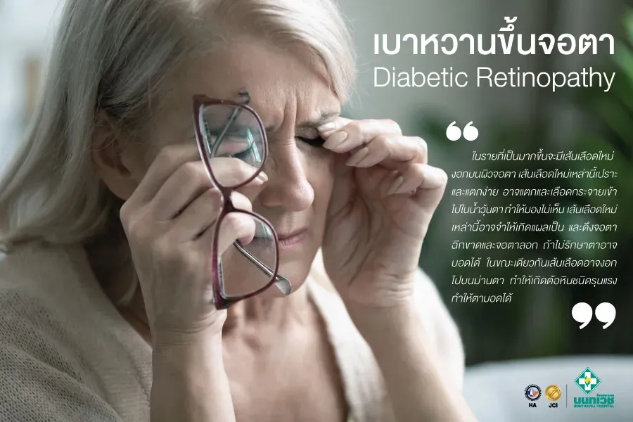 เบาหวานขึ้นจอตา Diabetic Retiopathy