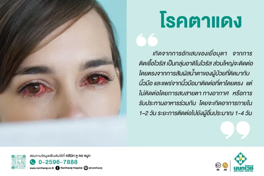 โรคตาแดง