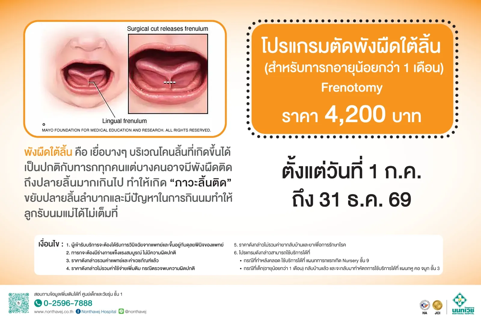 infant-tongue-tie-removal-program-2.jpg
