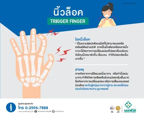 นิ้วล็อค