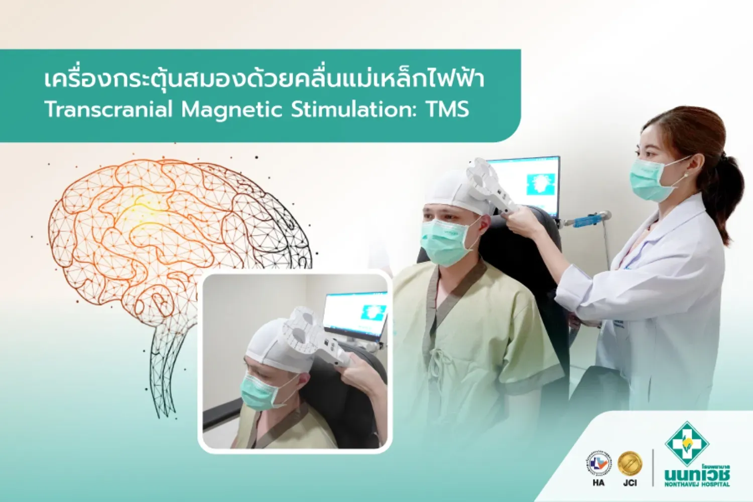 เครื่องกระตุ้นสมองด้วยคลื่นแม่เหล็กไฟฟ้า (Transcranial Magnetic Stimulation: TMS)