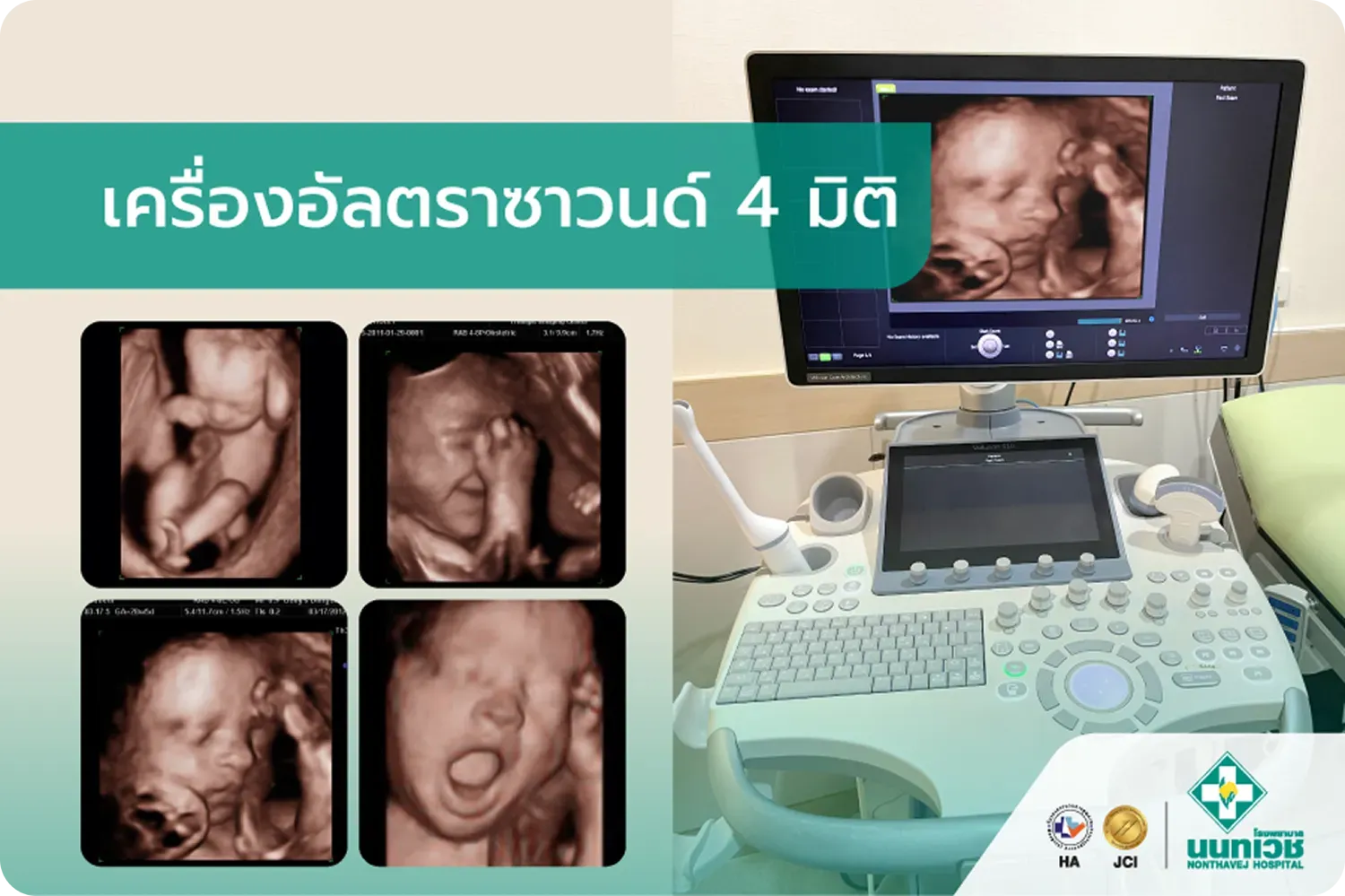เครื่องอัลตราซาวนด์ 4 มิติ