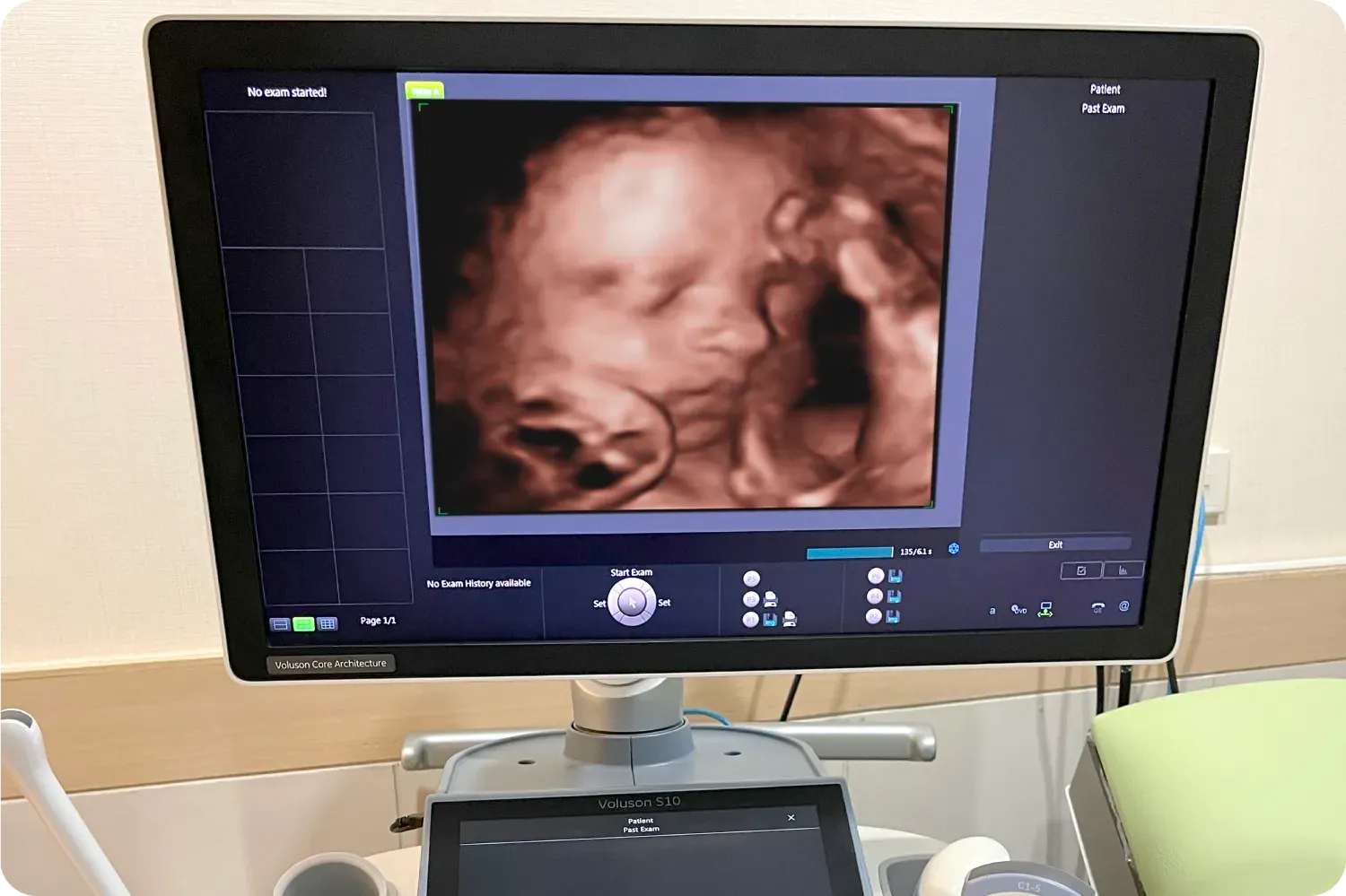 ultrasound-4d-pic.png